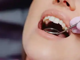 علامات في الفم تدل على إصابتك بمرض السكري