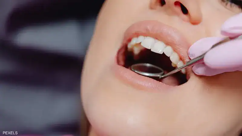 علامات في الفم تدل على إصابتك بمرض السكري