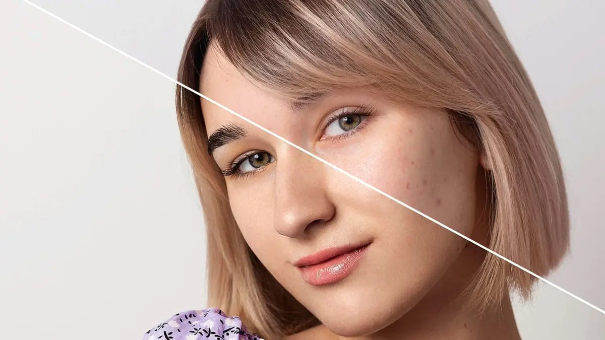 7 حلول قوية للقضاء على المسامات الواسعة..إتبعيها