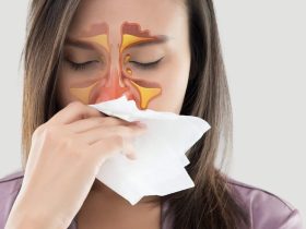 إلتهاب الجيوب الأنفية.. كل ما تريدين معرفته