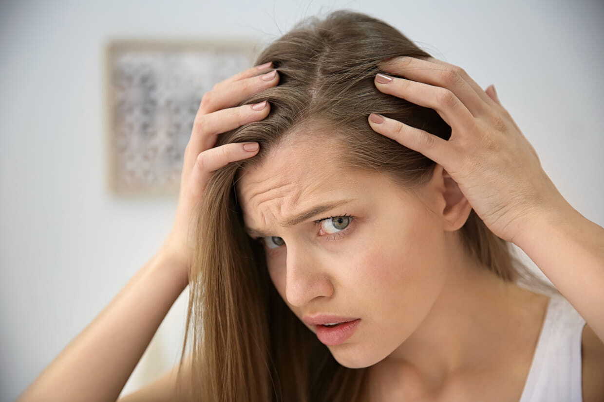 انحسار خط الشعر: أسبابه وطرق علاجه..وفقًا للخبراء
