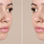 بثور البشرة: 6 أخطاء شائعة وكيفية تجنبها