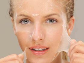 التقشير الكيميائي..هل حقًا الحل السحري لمشاكل البشرة.. ما القصة ؟