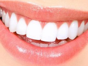 خاص| نصائح طبيب لـ أسنان صحية.. تمتعي بابتسامة هوليودية