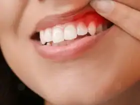 الأسنان