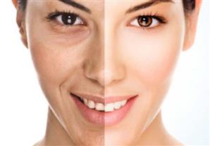 كيف تخلصيين من شحوب البشرة.. خطوات بسيطة