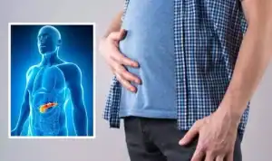 4 علامات في الساق قد تكشف عن سرطان البنكرياس..احذريها 