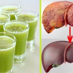 عصائر سحرية لمحاربة الكبد الدهني..احرصي على تناولها