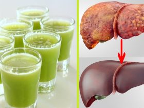 عصائر سحرية لمحاربة الكبد الدهني..احرصي على تناولها