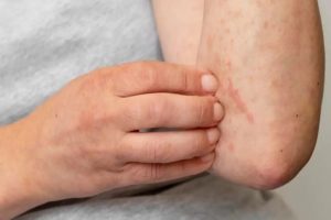 تجنب شربه في هذة الحالات .. الزنجبيل كنوز صحية وأضرار محتملة