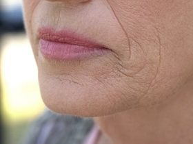 تسبب ظهور التجاعيد.. 6 عادات يومية احرصي على تجنبها للتمتع ببشرة صافية وجميلة