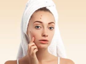 حب الشباب قد يكون علامة على سرطان نادر في الغدة النخامية يؤثر على الهرمونات