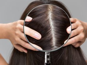 لماذا تظهر الحبوب على فروة الرأس وكيف نتخلص منها؟