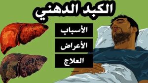 الكبد الدهني.. الأسباب و الأعراض، ومشروبات طبيعية لدعم صحته