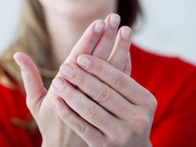 علامات تشير إلى إصابتكِ بالأنيميا.. احرصي على تناول هذه الأطعمة