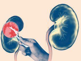 آخر ما وصل إليه العلم في علاج مرضى الغسيل الكلوي.. المتبرعون الأحياء بصيص أمل جديد