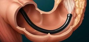 طرق فعالة وسريعة لتنظيف القولون في 8 دقائق… اكتشفها الآن!