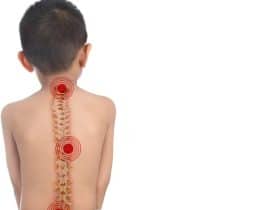 مشاكل العمود الفقري عند الأطفال: دليل شامل