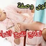 قروح الفراش: الأسباب، الأعراض، والوقاية