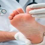 علاج قدم السكري: بين التحديات والحلول الطبية