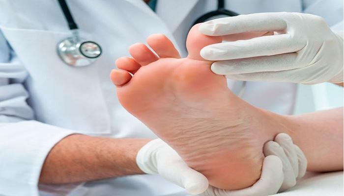 علاج قدم السكري: بين التحديات والحلول الطبية