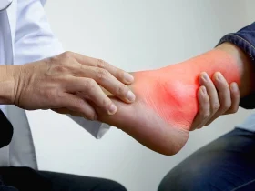 أعراض زيادة الأملاح في الجسم.. إنذار صامت لصحة الإنسان