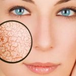 كيفية مكافحة الجفاف البشرة الموسمي.. الأسباب وطرق علاج .