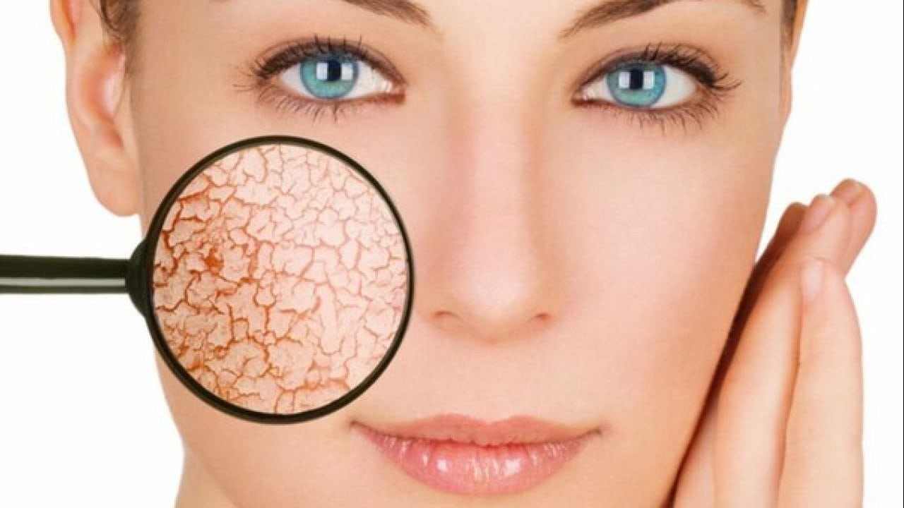 كيفية مكافحة الجفاف البشرة الموسمي.. الأسباب وطرق علاج .