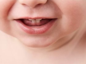 تسريع التسنين عند الأطفال.. بين الحقيقة والخرافة ونصائح التهدئة.