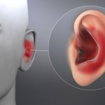 التهاب الأذن الداخلية.. الأسباب، الأعراض والعلاج