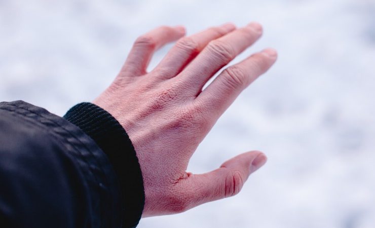  لسعة الصقيع.. فهم وعلاج والوقاية من تلف الجلد الناتج عن التجمد