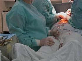 مخاطر جراحات السمنة وكيفية الوقاية منها.. انتبهي لها