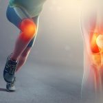 التواء الركبة.. الأسباب، الأنواع، وطرق العلاج لاستعادة النشاط