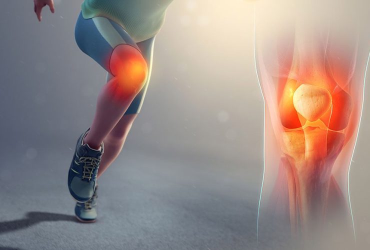 التواء الركبة.. الأسباب، الأنواع، وطرق العلاج لاستعادة النشاط