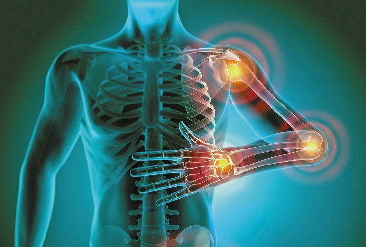 الالتهاب المزمن.. عندما يتحول نظام الدفاع في أجسامنا إلى عدوٍ خفي