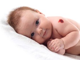 طفلكِ لديه شامة عند الولادة؟ إليكِ ما يجب معرفته