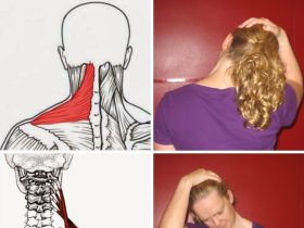 ضغط فقرات الرقبة .. دليل شامل للأعراض، والتدخلات العلاجية
