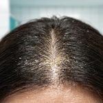 ترميم روابط الشعر.. كيف تعيد تقنية Fiber Rehab الحياة للشعر التالف؟