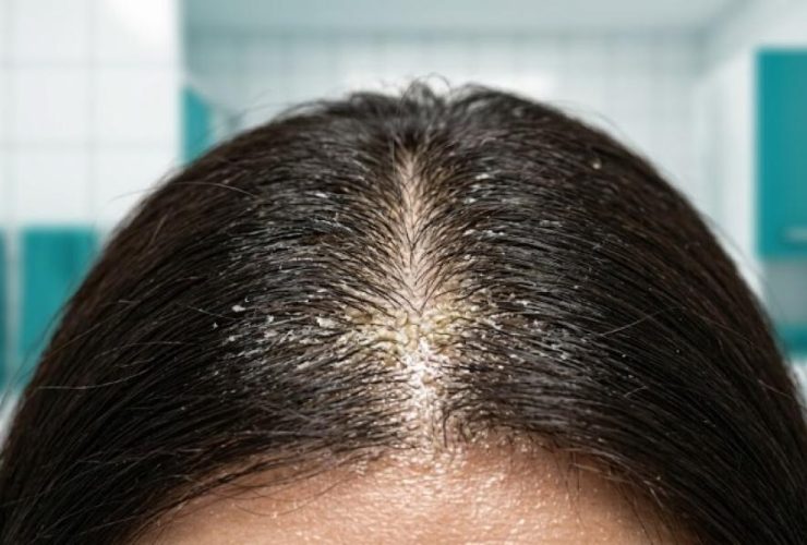 ترميم روابط الشعر.. كيف تعيد تقنية Fiber Rehab الحياة للشعر التالف؟