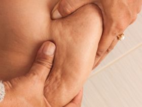 قوام منحوت بدون عيادات.. خطوات بسيطة لمواجهة السيلوليت