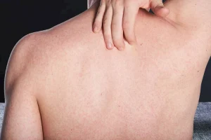 حمو النيل في الصيف.. 10 طرق فعالة لتخفيف الأعراض وتسريع التعافي