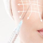 ثورة PLLA في الطب التجميلي.. كيف تعيد كرات حمض اللاكتيك المجهرية برمجة الكولاجين؟