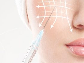 ثورة PLLA في الطب التجميلي.. كيف تعيد كرات حمض اللاكتيك المجهرية برمجة الكولاجين؟