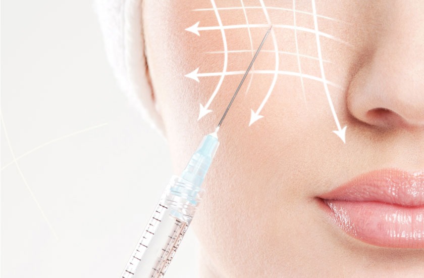 ثورة PLLA في الطب التجميلي.. كيف تعيد كرات حمض اللاكتيك المجهرية برمجة الكولاجين؟
