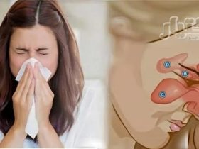 صيف بلا آلام.. دليل مواجهة التهاب الجيوب الأنفية في فصل الحر