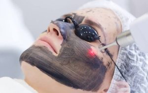 الليزر الكربوني أم الفراكشنال ليزر؟ دليلك لاختيار التقنية الأنسب لعلاج مشكلات البشرة