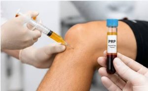 العلاج الذي يبدأ من داخلك.. كل ما تريدين معرفته عن حقن «PRP»