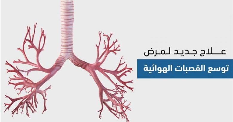 توسع القصبات الهوائية.. فهم المرض، أعراضه، واستراتيجيات التعايش معه