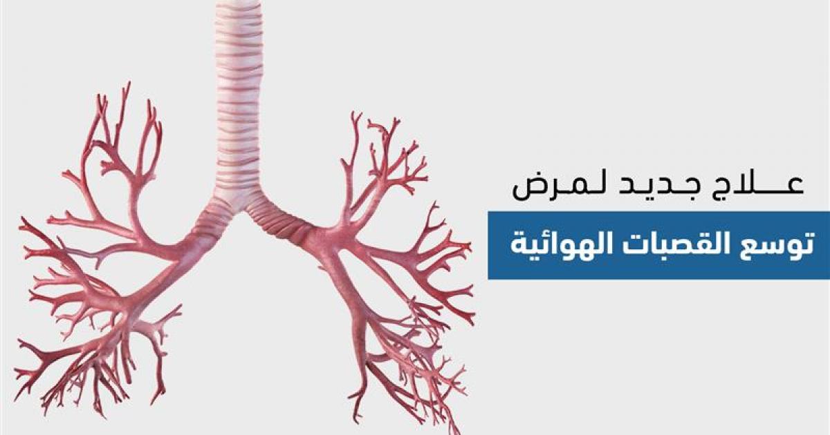 توسع القصبات الهوائية.. فهم المرض، أعراضه، واستراتيجيات التعايش معه