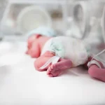 «متلازمة الضائقة التنفسية لدى حديثي الولادة».. أسبابها وأعراضها وطرق الوقاية منها